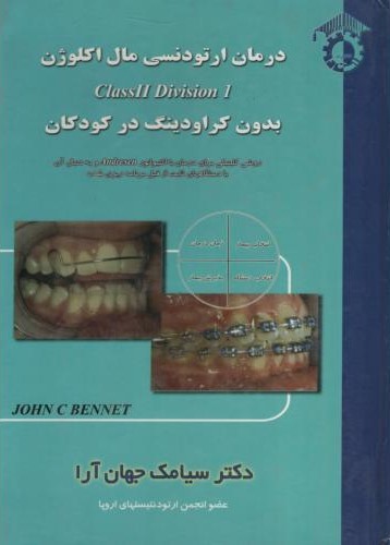 درمان ارتودنسی مال اکلوژن بدون کراودینگ در کودکان سیامک جهان آرا(استاد)