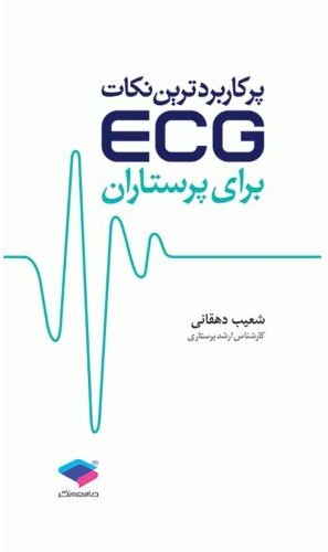 پر کاربردترین نکات ECG برای پرستاران(جامعه نگر)